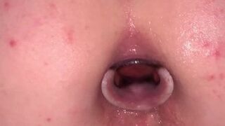 Rein in die Arschfotze